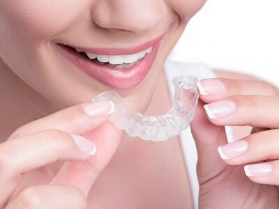 Esthetic Aligner Aparelhos Transparentes